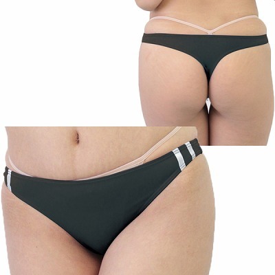 �Q�������X�g���b�`�u���}�s�o�b�N�@�u���b�N